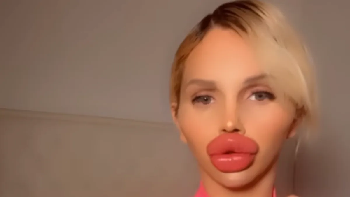 influencuesja-pretendon-te-kete-buzet-me-te-medha-ne-bote-por-ankohet-se-nuk-po-ha-pi-dhe-flet-dot