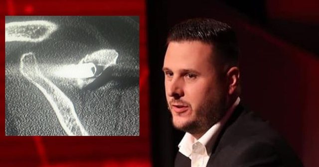 27 vite me plumb në trup  flet i mbijetuari i masakrës së Suharekës  U shtira si i vdekur  më kapën e më hodhën në kamionin e viktimave