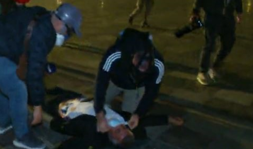 Përplasje në Sheshin  Skënderbej   Një person përfundon pa ndjenja gjatë ndërhyrjes së policisë