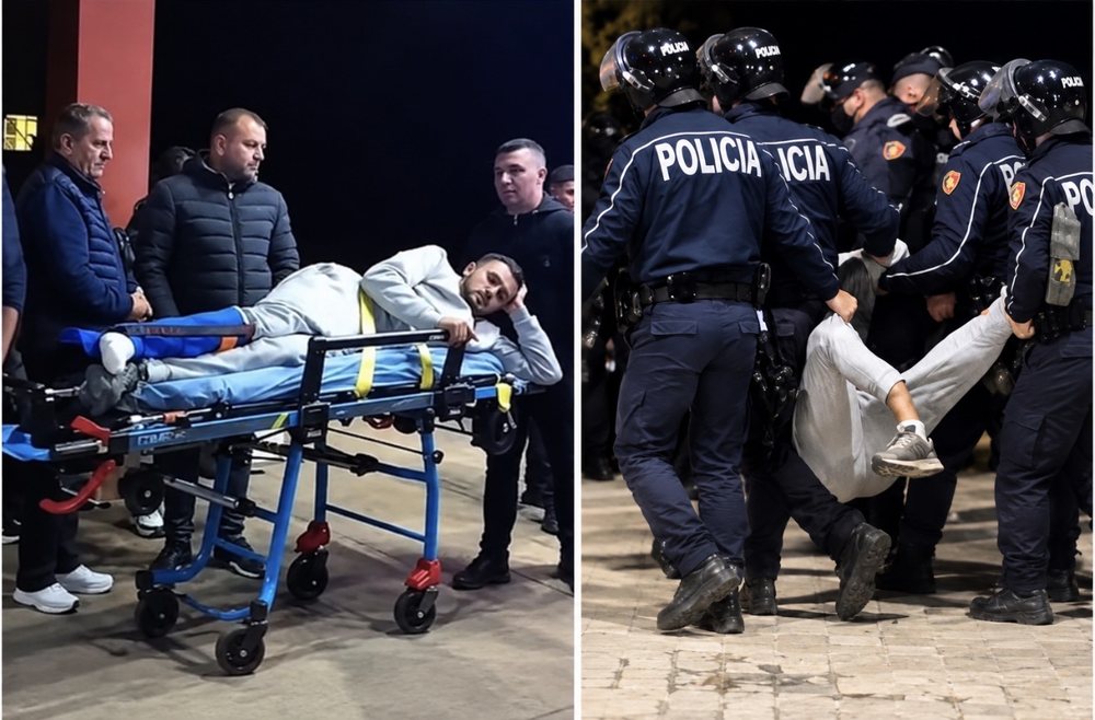  Ndjeva që u përplasa fuqishëm   dëshmia e Ledionit që policia i theu këmbën në protestë