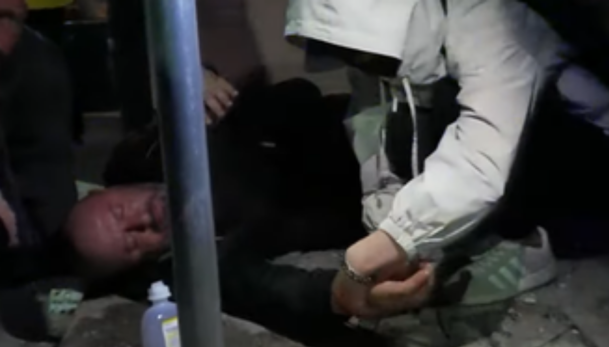 Publikohet foto e protestuesit që u rrah barbarisht me shkop gome nga forcat  Shqiponja 